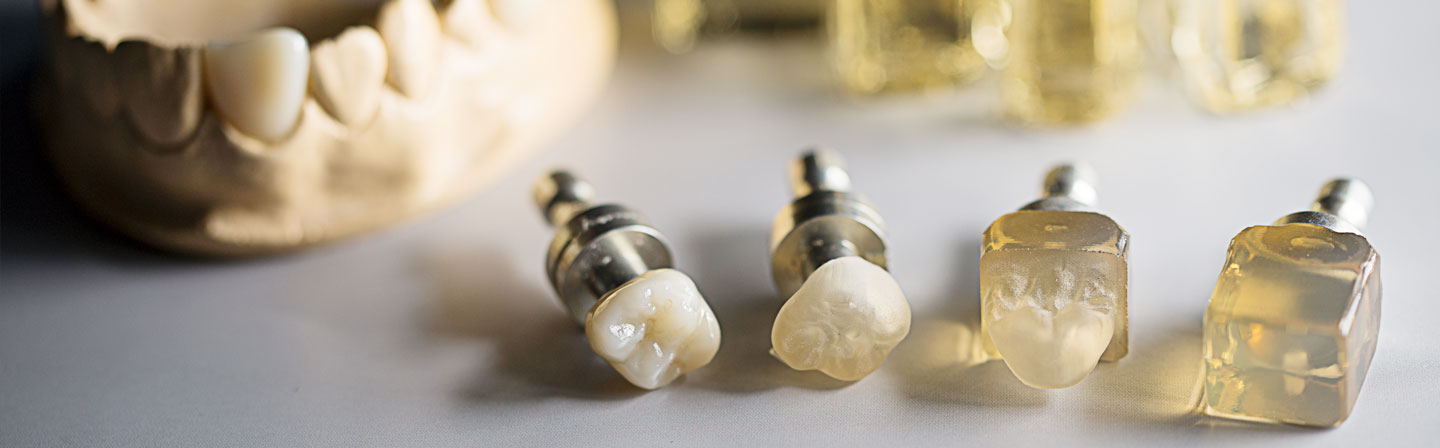 Glaskeramik für dentale Anwendungen