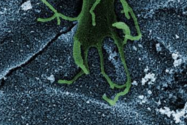 SEM image: a (stained) cell on a porous glass substrate.