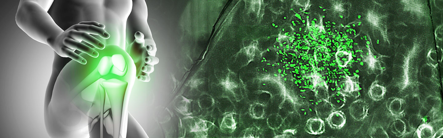 Bioactive glass implantology